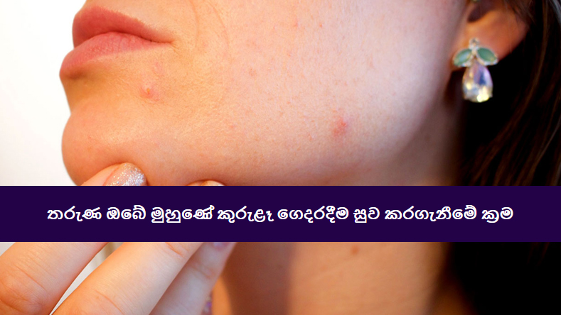 Top-Home-Remedies-For-Pimples--sinhala-article-by-kalavita-Sri-Lanka